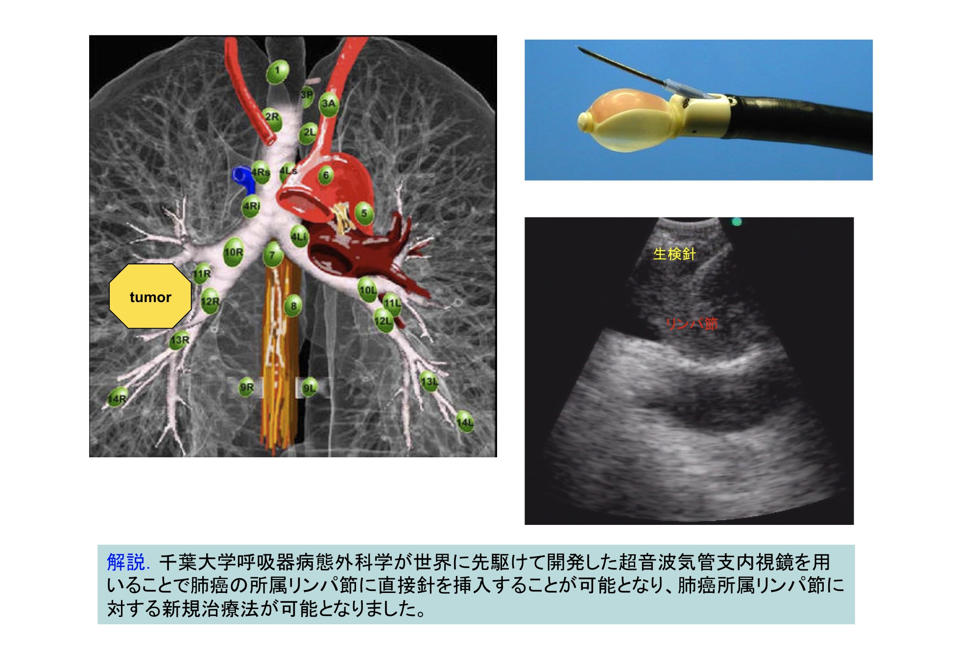細胞分化の本質はクロマチンリモデリングである。