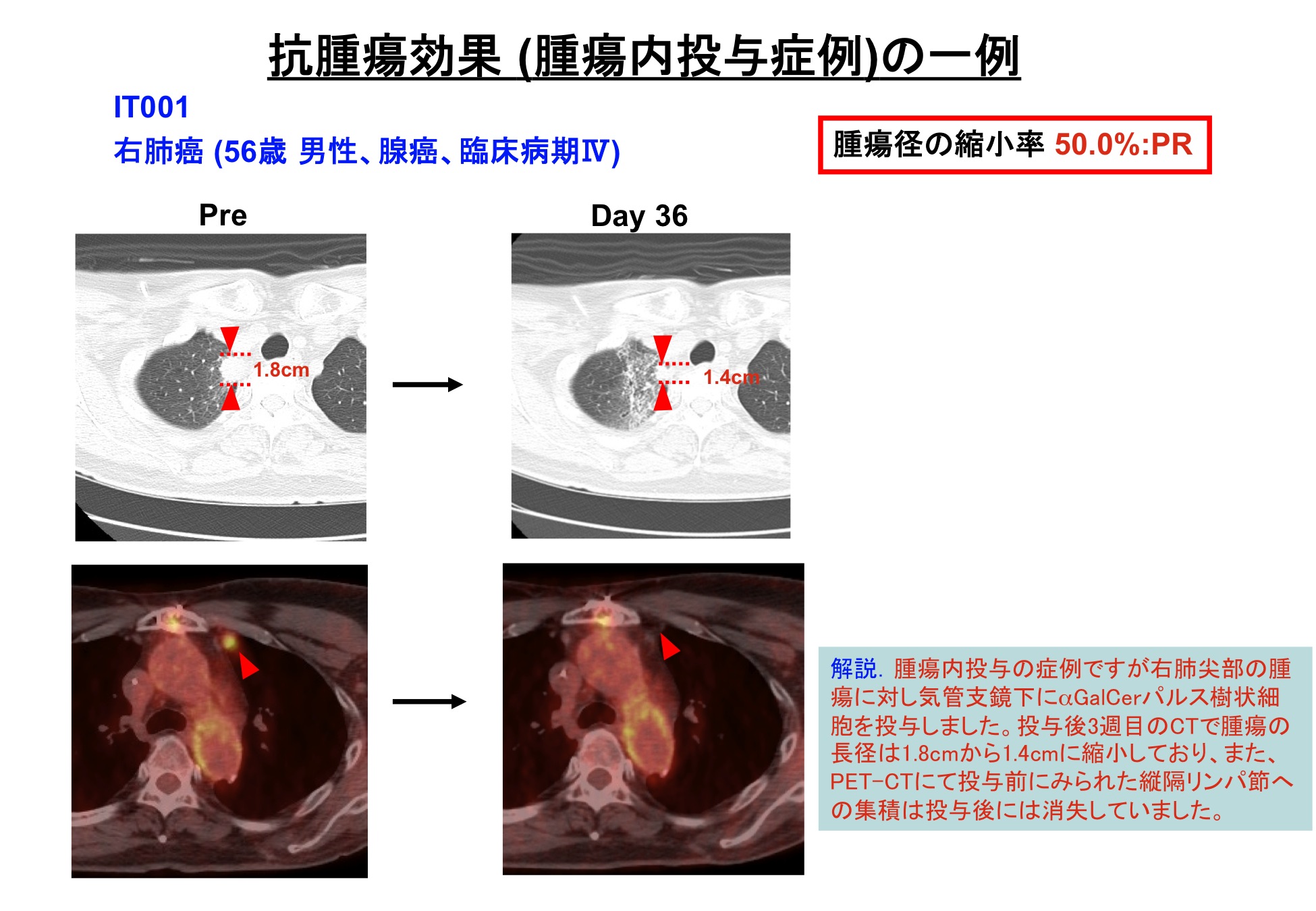 細胞分化の本質はクロマチンリモデリングである。
