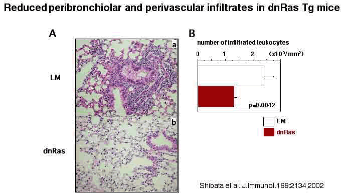 Reduced peribronchiolar and perivascular infiltrates in dnRas Tg mice