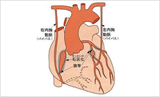 冠動脈疾患